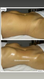 Resultados antes y después